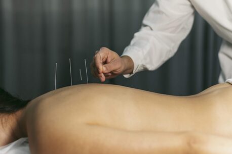 Chicago, Medical, Acupuncture Restoring Body Treatment In Chicago