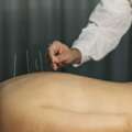 Acupuncture Restoring Body Treatment In Chicago