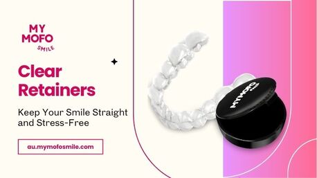 Sydney, Health & Beauty Items, AUD 189,  Custom Retainer For Teeth Straightening  &ndash; Shop Online