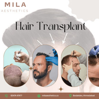 Ahmedabad, Health, Hair Transplant In Ahmedabad | FUE & DHI Expert Clinic