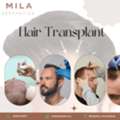 Hair Transplant In Ahmedabad | FUE & DHI Expert Clinic