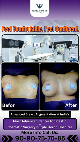 Jaipur, Health, Best Breast Surgery In Jaipur - Dr. Nitesh Lamoria