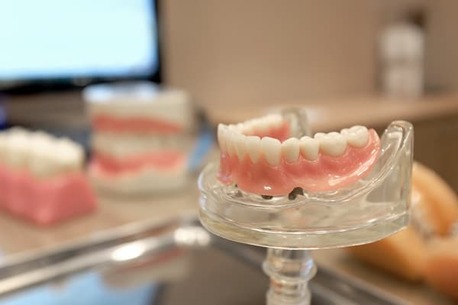 San Diego, Health, Are Dentures Implants Removable?