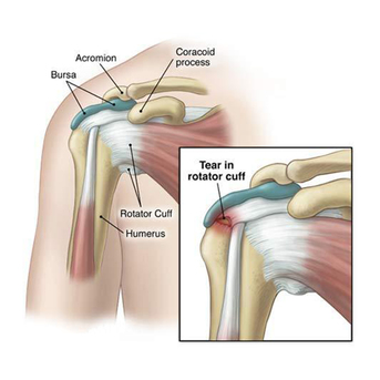 Mumbai, Health, Joint Pain Knee And Hip Replacements Specialist