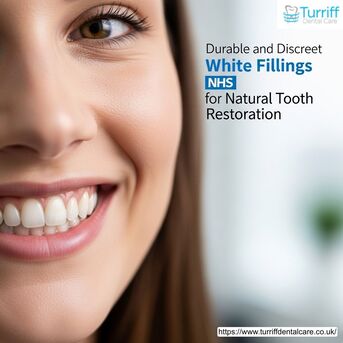 London, Dental, Durable And Discreet White Fillings NHS For Natural Tooth Restoration