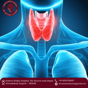 Ahmedabad, Health, Advanced Care By Thyroid Cancer Surgeon In Ahmedabad - Dr. Natasha Lalwani