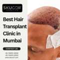 Best Hair Transplant Clinic In Mumbai: Why Skuccii Supercliniq Stands Out