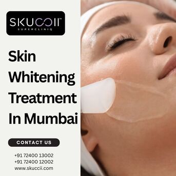Mumbai, Business, Skin Whitening Treatment In Mumbai By Experts At Skuccii Supercliniq