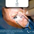 Advanced Cataract Surgery In Ahmedabad At Shree Eye And Dental Hospital