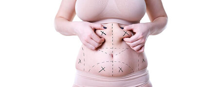 Mumbai, Health, Can I Get Multiple Areas Of Liposuction At Once?