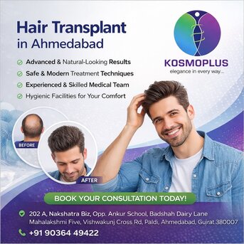 Ahmedabad, Health, Expert Hair Transplant Treatment In Ahmedabad | Kosmo Plus Hospital