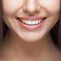 Professional Services At Millcroft Dental Care