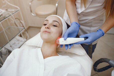 New Delhi, Medical, Facial Hair Removal Laser Treatment At Dermapuritys
