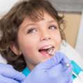 Walk-In Dental Care In Fort Worth