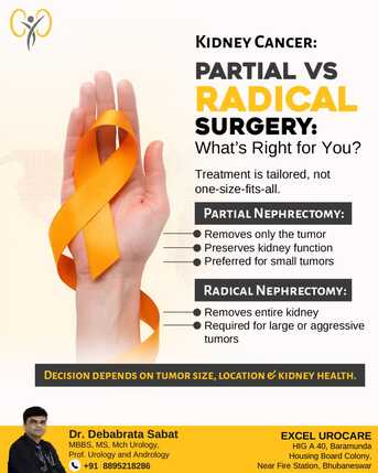 Bhubaneswar, Health, Kidney Cancer Surgery | Best Urologist In Bhubaneswar | Dr. Debabrata Sabat
