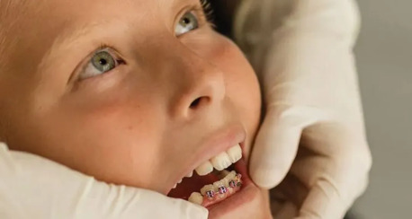 Perth, Dental, Learn Why Choosing A Nearby Dental Clinic Makes All The Difference