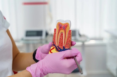 The Hague, Dental, Op Zoek Naar Een Veilige En Zachte Wortelkanaalbehandeling In Almere?