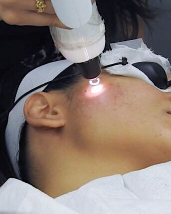 New York, Business, Laser Facial Treatment Nearby