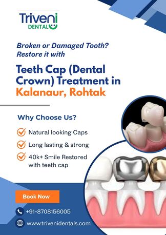 Haryana, Dental, Teeth Cap Treatment In Kalanaur, Rohtak | Triveni Dental