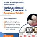Teeth Cap Treatment In Kalanaur, Rohtak | Triveni Dental