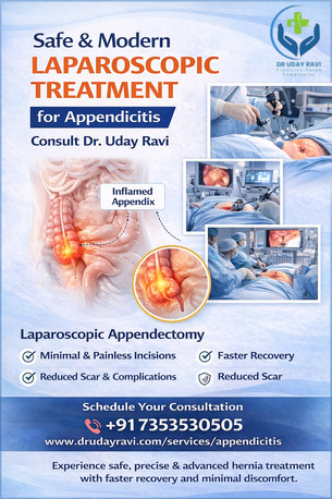 Bangalore, Health, Safe & Modern Laparoscoipic  Treatment For Appendicitis &ndash; Consult Dr. Uday Ravi