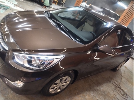 Jeddah, Vehicles, Cars & Trucks , SAR 30,  Hyundai Accent,  2017,  Automatic,  145334 KM,  Urgent Car Sale