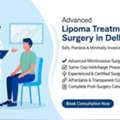 Best Lipoma Surgery Options For Painless Lump Removal
