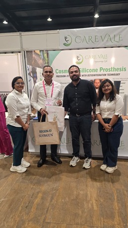 Hyderabad, Health, Free Artificial Leg In Hyderabad | CareVale Prosthetics