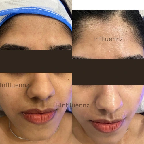 New Delhi, Health, Best Skin Care Clinic In Delhi