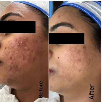 New Delhi, Health, Best Skin Care Clinic In Delhi