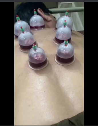 Riyadh, Job Seekers, Physiotherapist  أخصائي العلاج الطبيعي