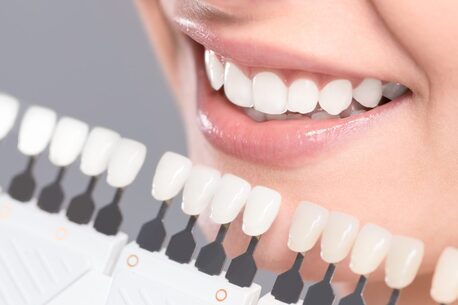 Miami, Health, Get A Sparkling Smile With The Best Pain Free Teeth Whitening