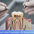 Best Pain-Free Root Canal Treatment In Mumbai | AK Dental Clinic