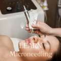 Microneedling Tampa For Smooth, Radiant & Youthful Skin