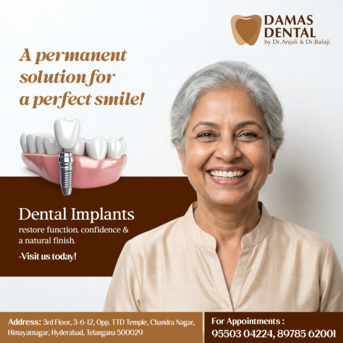 Hyderabad, Dental, Dental Implants In Himayathnagar | Damas Dental