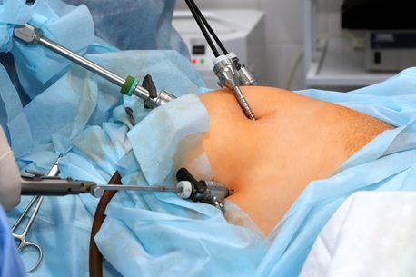 Rohini, Health, Advanced Laparoscopic Surgery Near Me By Expert Surgeons