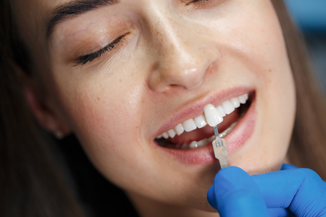 Mumbai, Health, Are Veneers Permanent? What You Should Know