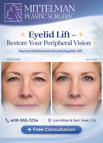 New York, Health, Eyelid Lift In Los Altos And San Jose CA Improves Vision Naturally