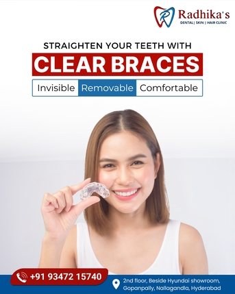 Hyderabad, Health, Clinic Is Your Go-to Choice For All Your Dental