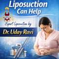 Best Liposuction Surgeon In Bangalore - Dr.Uday Ravi, Yelahanka