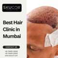 Best Hair Clinic In Mumbai For Modern Hair Care Technology