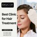 Best Clinic For Hair Treatment: Achieve Healthier Hair With Skuccii Supercliniq