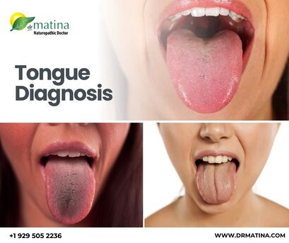 New York, Health, Tongue Diagnosis For Holistic Health Insights | DrMatina
