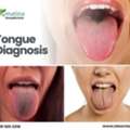 Tongue Diagnosis For Holistic Health Insights | DrMatina