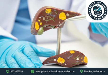 Mumbai, Health, Best Liver Transplant Doctor In Mumbai For Expert Liver Surgery &ndash; Dr. Chetan Kalal