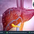 Best Liver Biopsy Procedure In Mumbai | Liver Testing By Dr. Chetan Kalal