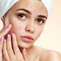 Acne Treatment In Ahmedabad | Advanced Skin Care At Rejuva Aesthetica
