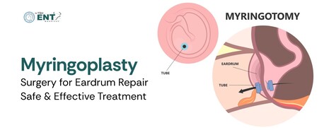 Mumbai, Health, Myringoplasty Surgery For Eardrum Repair &ndash; Safe & Effective Treatment