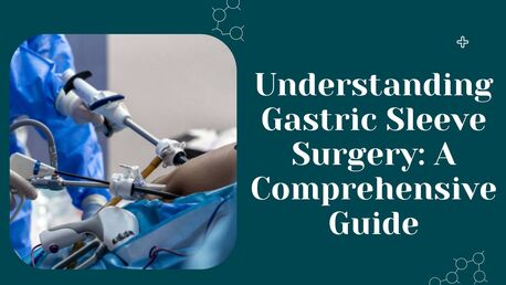 New York, Health, Understanding Gastric Sleeve Surgery: A Comprehensive Guide