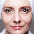 Facial Rejuvenation Treatment For Youthful Skin
